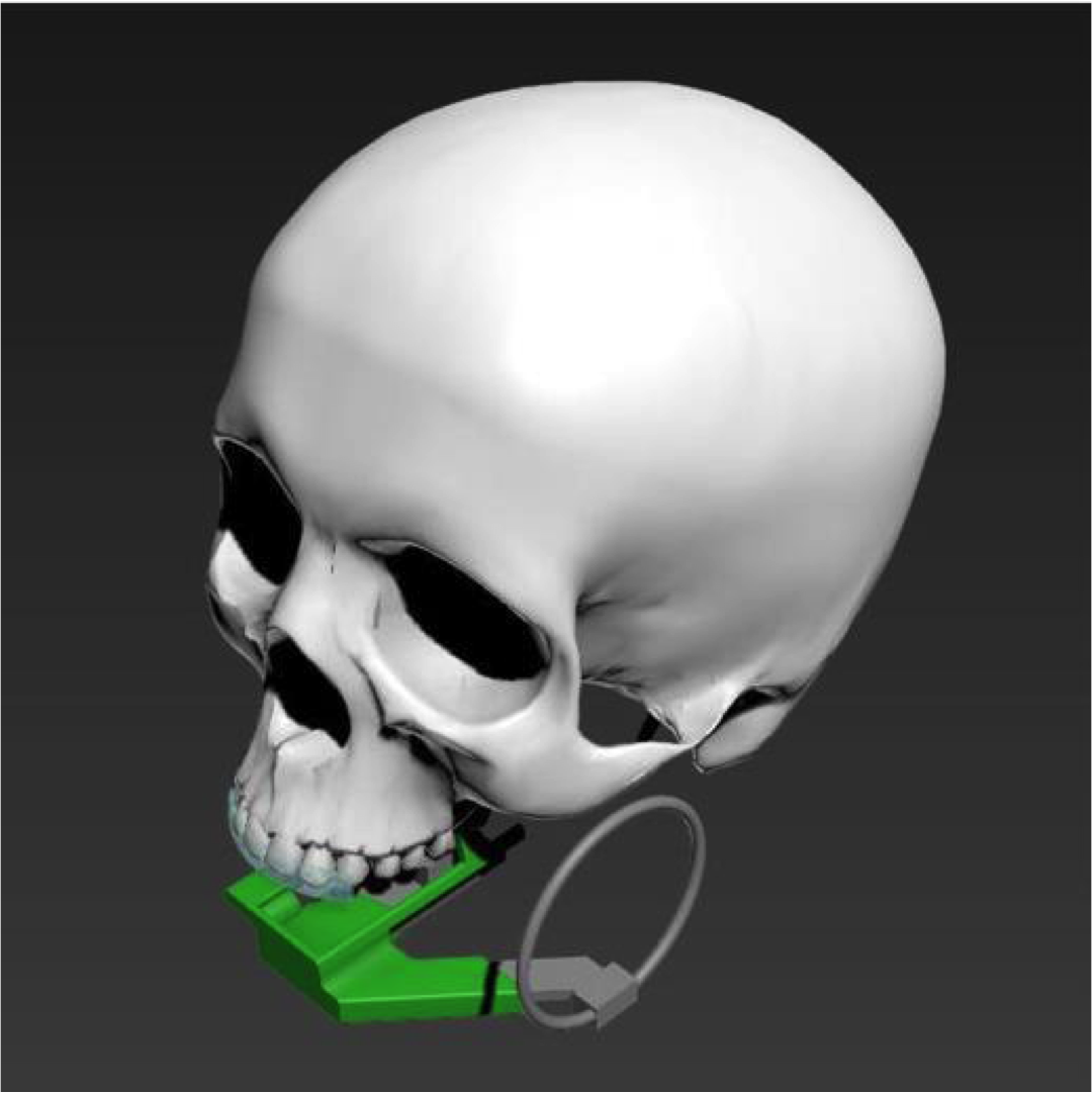 DENTAL RADIOGRAPHIC INDIVIDUALIZED POSITIONER